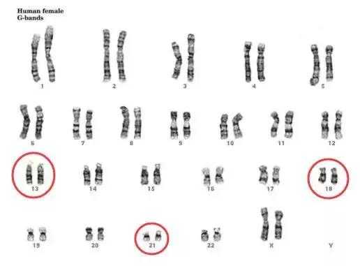 染色体dna检查是什么样的图片（dna染色体检查报告如何分析）