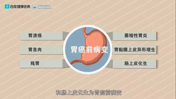 胃癌是什么因果（胃癌 成因）-图2