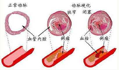 查血管子代表什么（查血管的叫什么）-图2