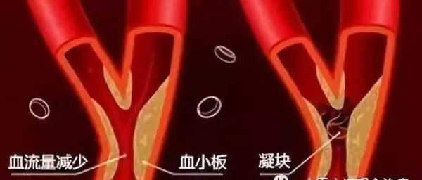 查血管子代表什么（查血管的叫什么）-图3